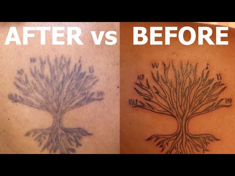 where to get ephemeral tattoo